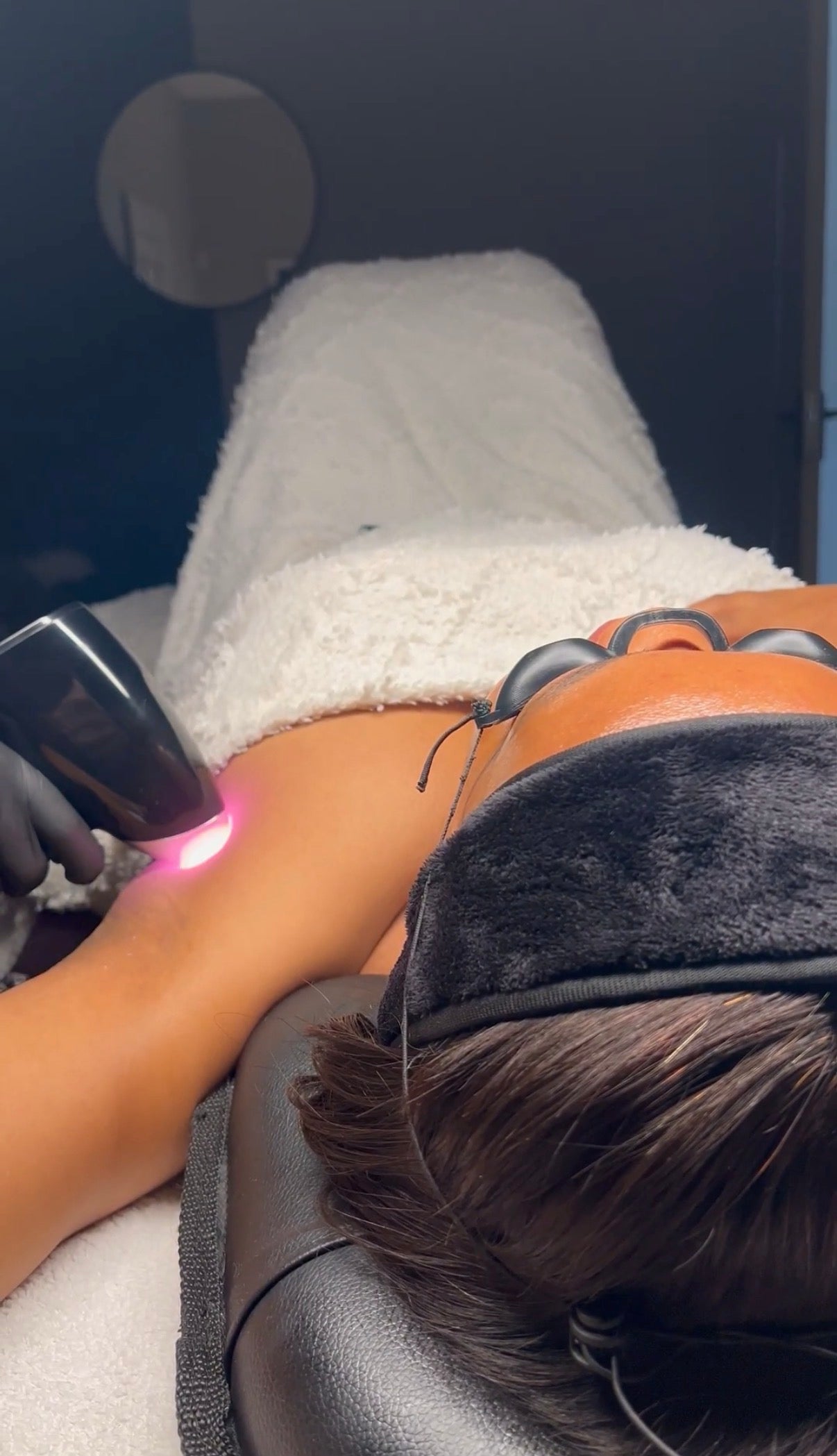 Therapist performing laser hair removal on a client's underarm at Revive Aesthetic Spa